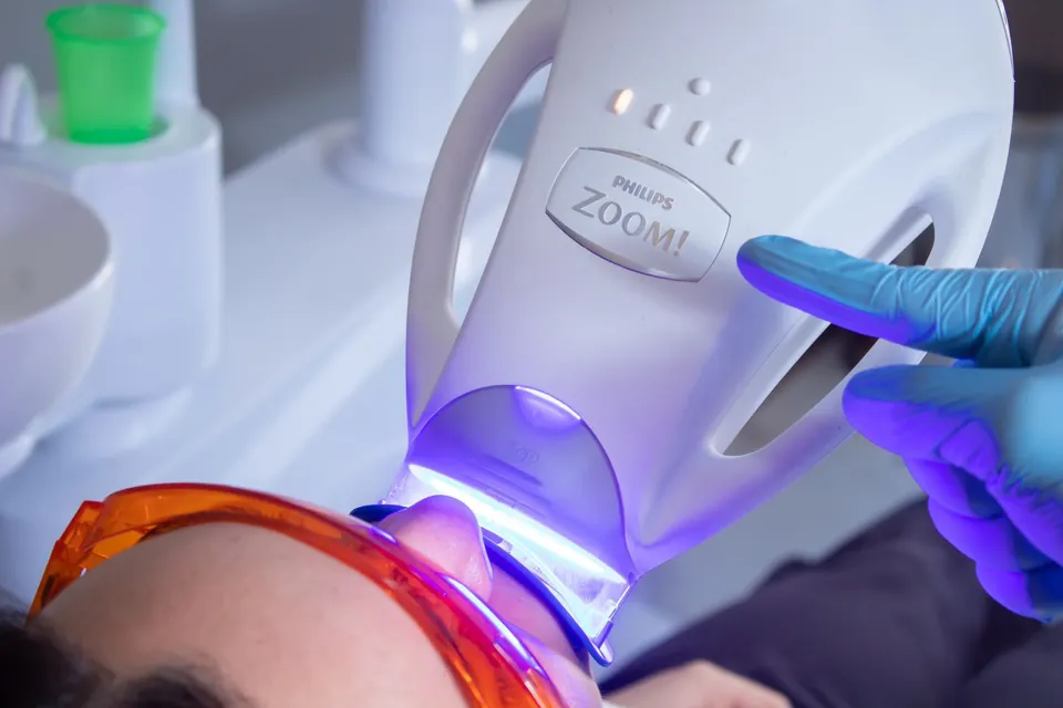 Lámpara de blanqueamiento dental Philips Zoom durante un tratamiento en Alta Dental Especialidades